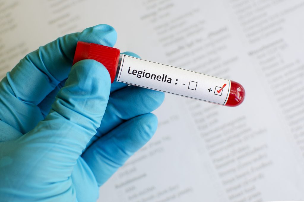 prevención y control de la legionelosis