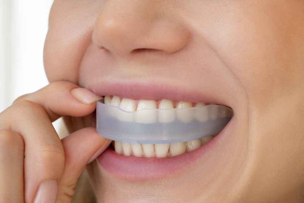 férula de descarga para bruxistas