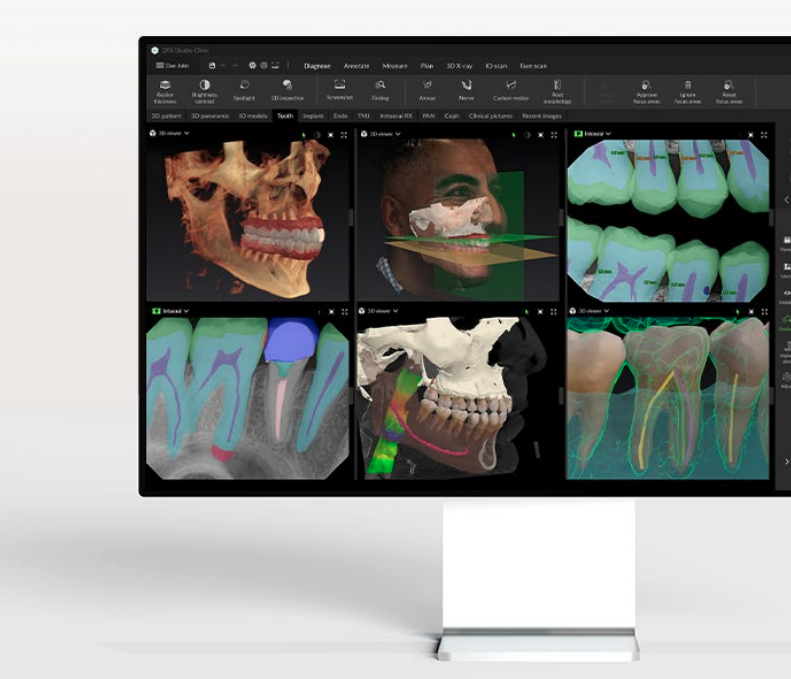 Descubre DTX Studio Clinic de DEXIS, el software de imagen dental con IA que integra imágenes 2D/3D, diagnóstico, planificación y comunicación clínica.