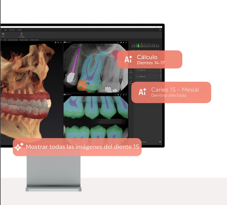 Descubre DTX Studio Clinic de DEXIS, el software de imagen dental con IA que integra imágenes 2D/3D, diagnóstico, planificación y comunicación clínica.